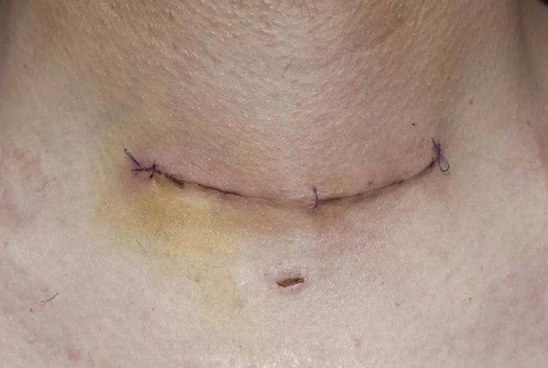 دکتر ندول تیروئید - کرج